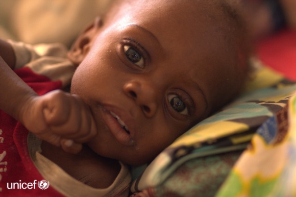 Głód zabija dzieci w Afryce Wschodniej i Południowej! Dziecko, LIFESTYLE - UNICEF Polska apeluje o pomoc! 26,5 mln dzieci w Afryce Wschodniej i Południowej potrzebuje natychmiastowej pomocy humanitarnej.