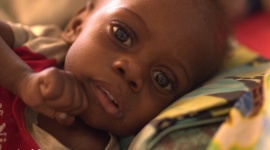 Głód zabija dzieci w Afryce Wschodniej i Południowej!