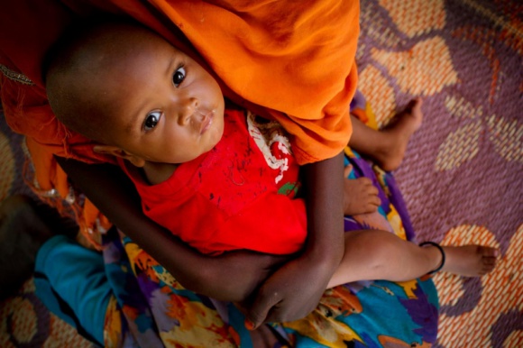 UNICEF: 7,5 mln dzieci na świecie umiera z głodu