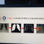 Stworzone w Polsce technologie rozpoznają koronawirusa na zdjęciu rentgenowskim czy tomografii komputerowej [DEPESZA]